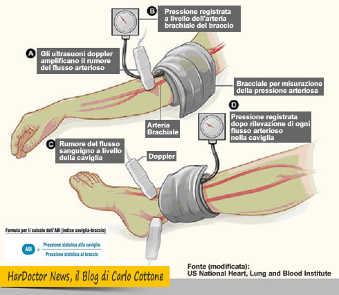 Arteriopatie: indice caviglia/braccio (ABI) ha significato clinico e prognostico